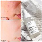 سرم لایه بردار سالیسیلیک اسید 2% سلوشن اوردینری - The Ordinary Salicylic Acid 2% Solution
