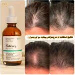 سرم مولتی پپتید پرپشت کننده و ضخیم کننده مو اوردینری - The Ordinary Multi-Peptide Serum for Hair Density