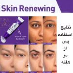 کرم دور چشم بازسازی‌کننده Cerave Skin Renewing Eye Cream روشن‌کننده، آبرسان و ضد چروک پوست حساس دور چشم با فرمول تخصصی Cerave