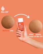 روغن ترمیم‌کننده پوست بایو اویل Bio-Oil – کاهش جای زخم، لک و ترک‌های پوستی